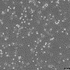 Human Intrahepatic cholangiocarcinoma cell line HuCC-T1