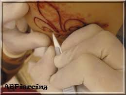 Résultat de recherche d'images pour "scarification"