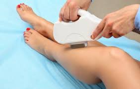 One year of laser hair removal on a small, medium, or large area at paradise med spas of texas (up to 94% off). Shr Super Hair Removal Laser Hair Removal The Skin Cellar
