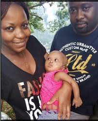 Destaque da semana: bebê nasce com marca escura e com cabelos no rosto