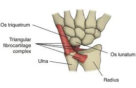 Impaction Syndrome: Elimination Of Ulnar Pain