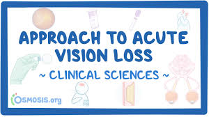 Image result for Acute Vision Loss