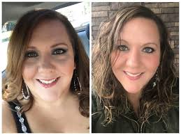 Are timolol eye drops affecting your vision?