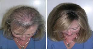 Cette Huile Est Tres Efficace Elle Permet La Repousse Des Cils Des Sourcils Et Des Cheveux Pousse Des Cheveux Perte De Cheveux Chute De Cheveux