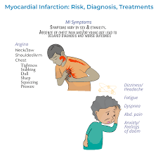 Image result for Myocardial Infarction Stabilization