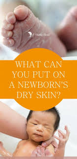 What Can You Put On A Newborn S Dry Skin Newborn Dry Skin Baby Dry Skin Newborn Skin Peeling