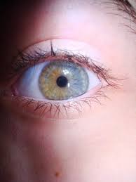 It is usually genetic, but rarely a sign of health conditions. Heterochromia General Off Topic Off Topic Minecraft Forum Minecraft Forum
