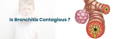 Image result for Acute Bronchitis