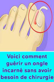 Il faut faire attention et les soigner. Voici Comment Guerir Un Ongle Incarne Sans Avoir Besoin De Chirurgie Lip Service Natural Nutrition Medical