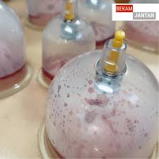 Senaman mampu untuk membuang angin dalam badan. Cup Bekam Berwap Tanda Banyak Angin Dalam Badan My Rehab Spa