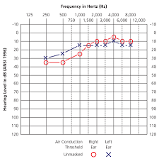 audiometry screening and interpretation american family