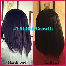 Learn how to reverse hair loss and grow amazing hair that's thicker, longer & stronger. Amazon Com Trl Faster Hair Growth Oil Beauty