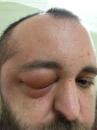 Prayers for Tyler Osteen's full Recovery