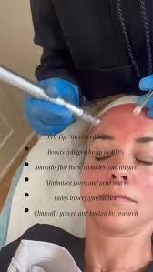 “If I could turn back time… oh wait, I can.✨ Microneedling with PRP at  Beautybird Med Spa boosts collagen, smooths skin, and brings back that  glow.”, #beautybirdmedspa #microneedlingtherapy ...