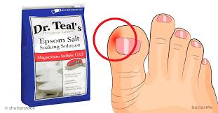 How to get rid of an ingrown toenail overnight. 6 Surprisingly Effective Ways To Get Rid Of Ingrown Toenails