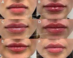 Pin On Lips