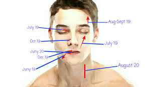 Medulloblastoma — Brain Tumor. My name is Rakha, 23 years old, a male…