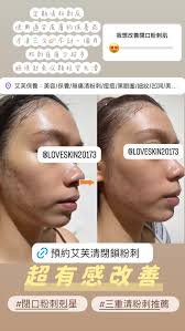 歡迎來找我們免費諮詢皮膚後, 搭配適合肌膚保養品給您使用, 全台都有店家可以服務, 預約👉🏻 https://lin.ee/2mO8LTm