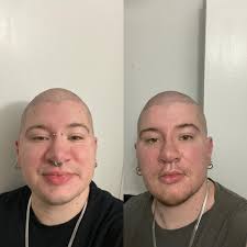 Feral Neurodivergent Raging Meme Posting