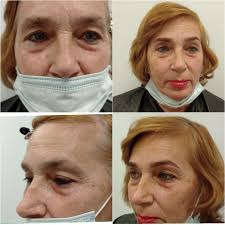 Возможно ли изменить лицо без пластической операции? Я отвечу, что ДА! Но с  помощью оформления бровей, именно на столько они влияют на образ человека.  С помощью бровей можно даже визуально менять настроение