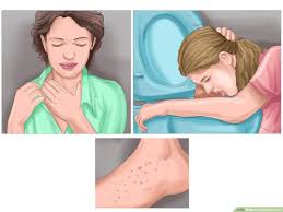 There are two types of fever baths. 4 Ways To Reduce A Fever Wikihow