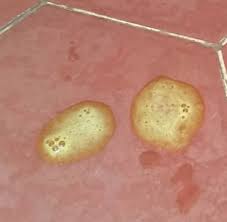 Mi Perro Vomito Dog Dog