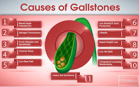 Beat Gallstones Naturally Gallstones Gallbladder Symptoms Gallbladder Stones