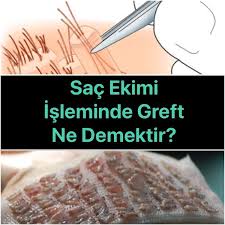 Sac Ekimi Isleminde Greft Ne Demek Ne Ifade Etmektedir Sac Ekim