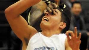 Central Valley dealing with injuries