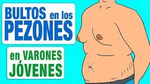 Bultos En Los Pezones En El Varon Adolescente Pierdales El Miedo Youtube
