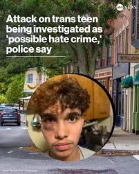 A trans teenager was allegedly assaulted by a large group of teens in  Massachusetts, and police are investigating it as a possible hate crime.  Jayden Tkaczyk, 16, says he attended an outdoor