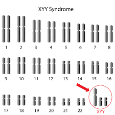 47 Xyy Syndrome Medlineplus Genetics