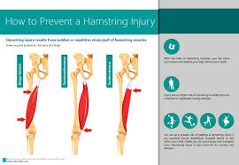 Injury to the hamstring requires what's called rice treatment: How To Prevent A Hamstring Injury