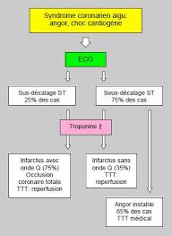 L'infarctus dy myocarde, quels en sont les symptômes , comment le diagnostiquer et comment le traiter. 9 5 Traitement De L Ischemie Myocardique Precis D Anesthesie Cardiaque 5
