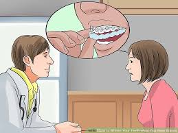 Check spelling or type a new query. How To Whiten Teeth With Braces At Home Fast Teethwalls