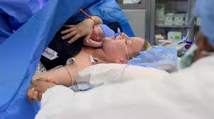 Find the best hospital in hawkesbury, on. St Paul S Hospital First In Canada To Trial Maternity Positioning Band In Operating Room Ctv News