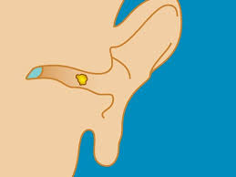 Ear bleeding caused by a superficial cut or an object removed from the ear may not require medical attention. Ear Discharge Causes Treatments And Prevention