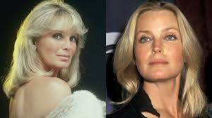 Dynasty' star Linda Evans says she's friends with Bo Derek after 'horrible'  John Derek affair