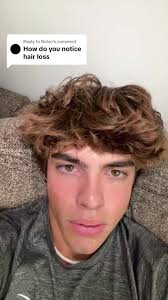 Replying to @Nolanwatch this so you wont go bald ⁉️😱 #dillonlatham  #selfimprovement #hairloss