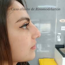 Dr. Esteban Huerta G. (@dr.estebanhuertag) • Instagram photos and videos