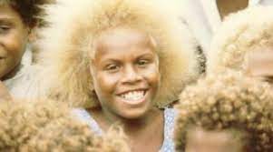 The melanesians have a native tyrp1 gene which partly has blond hair and melanin and completely differs from caucasians because it does not exist in their genes. Melanesians Have Blond Hair And Dark Skin Many Argue They Re Not Of African Descent Video Photos Eurweb