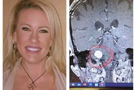 Fundraiser by Jesse Yoder : Jesse's Save The Brain Campaign