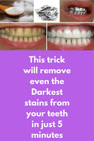 How to prevent coffee from staining your teeth and stop teeth discoloration. Pin On Beauty Tips