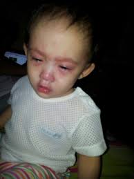 Should a child with roseola see a doctor? Familie Mohamadhafidh