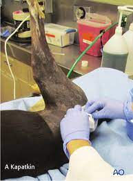 Click to see full answer. Lateral Recumbency Position