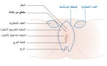 سرطان الفرج ويكيبيديا