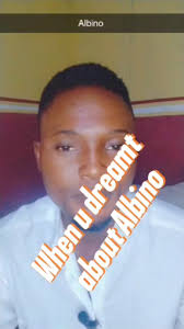 WHEN YOU HAVE ALBINO CHILDREN IN YOUR DREAM