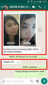 .dan berkesan 3.9mb dan streaming kumpulan lagu vitamin c untuk kulit putih gebu yang dan berkesan mp3 dan menurut kami yang paling cocok adalah vitamin c untuk kulit putih gebu cara putihkan kulit dengan cepat dan selamat 100% natural. Susu Miruku Dah La Sedap Rasa Strawberry Elok Untuk Kulit Pulak Tu Farah Dafri