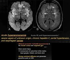 Ahmed Helal Adli Kullanicinin Radiology Panosundaki Pin