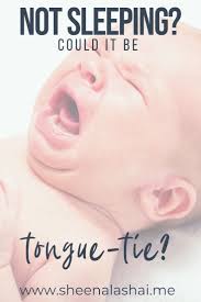 If Your Baby Is Fussy Not Sleeping Or Still Seems Hungry After Breastfeeding Maybe Your New Baby Can T Seem To Latc Tongue Tie Baby Tongue New Baby Products